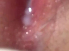 우리 보미 숨쉴때마다 물흘러나와요