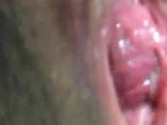 털때문에 고민중 ㅠㅠㅠ 빼꼼빼꼼