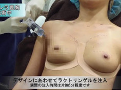 非常漂亮的美女 丰胸手术