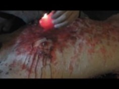 burner wax 蝋燭責め　バーナーで絶叫