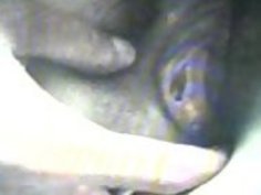 （033）Zhangjiajing看護師（台湾）