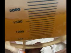 尿道プレイ　尿道カテーテルを膀胱まで挿入しておしっこバッグに導尿